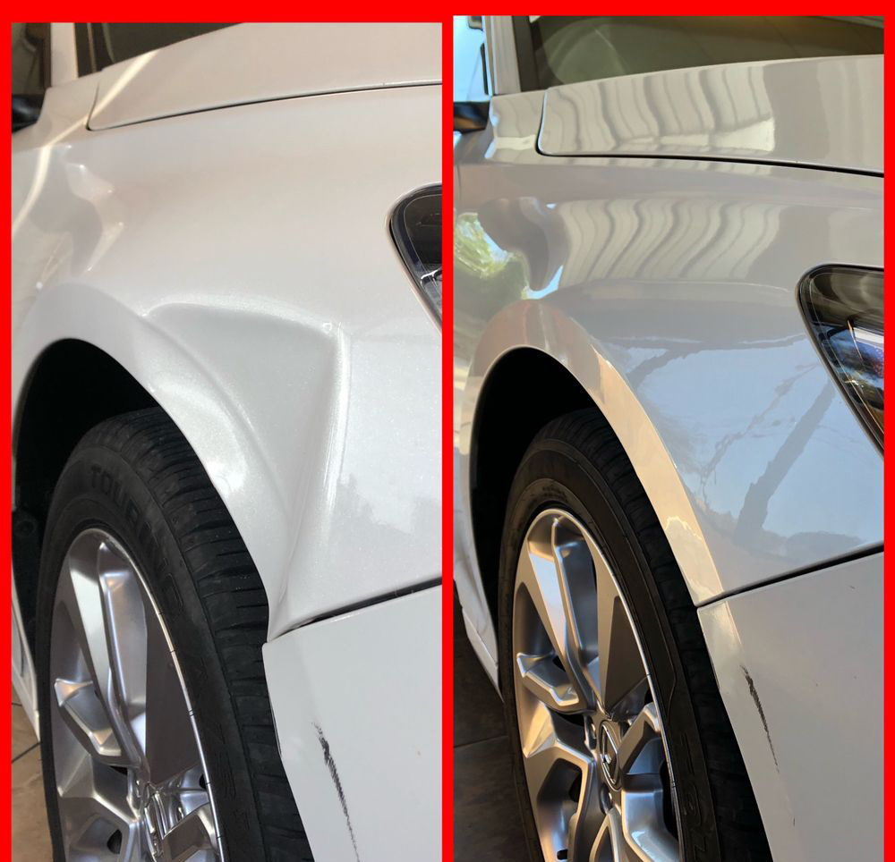 Dent Removal